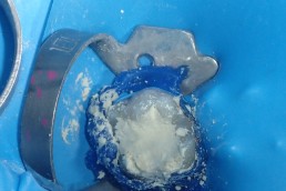 « Biodentine » en place